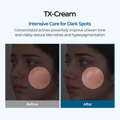DR.Melaxin TXA Tranexamic Acid CREAM | Skin freckle Cream, Blemishes, Anti-pigmetation korean skin care | Korean Cosmetics | 1.7 fl oz (50 ml)