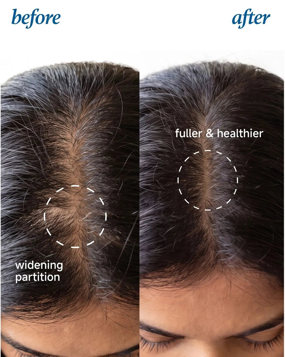 Advanced Hair Growth Serum Roll On (25ml)