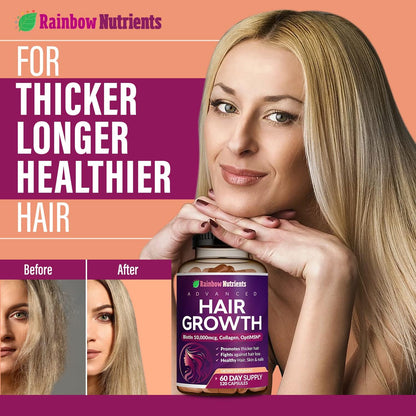 Hair Growth Vitamins for Women | Biotin 10,000mcg, Collagen, Patented OptiMSM®, goMCT®, Saw Palmetto | Naturally Supports Stronger & Healthier Hair, Skin and Nails |Non GMO + Made in USA|60 Day Supply